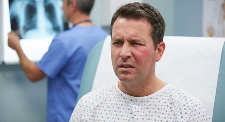 Patient présentant un gonflement important de la joue dû à un abcès dentaire purulent