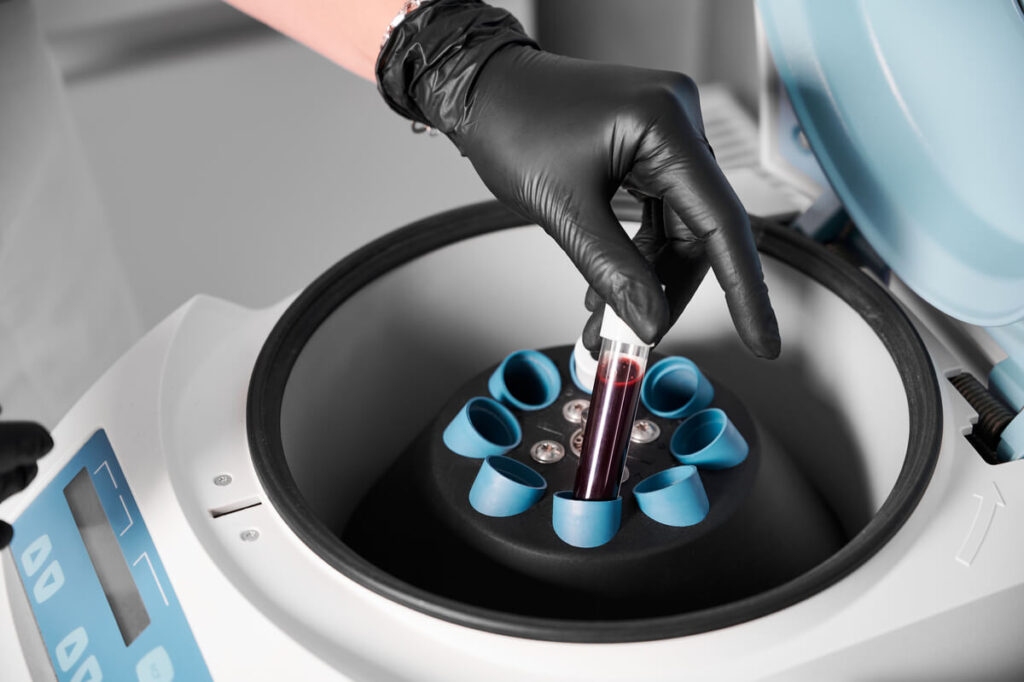 Des tubes d'analyse de sang insérés dans un automate d'analyse médicale en laboratoire.