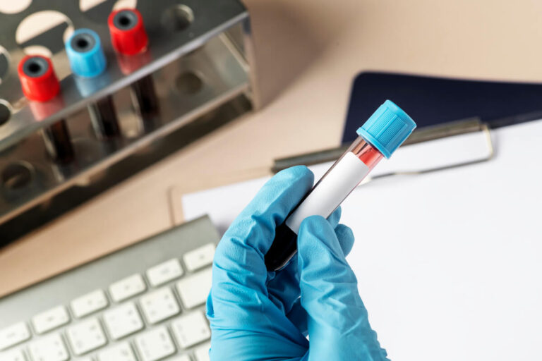 Un tube de prélèvement sanguin en laboratoire destiné à la recherche d'anticorps auto-immuns.