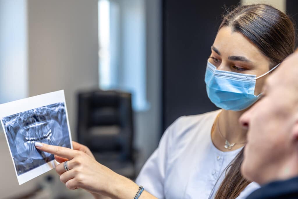 Polype pulpaire : définition, causes et traitement 3 Une radiographie affichant la structure interne d'une dent cariée avec sa racine.