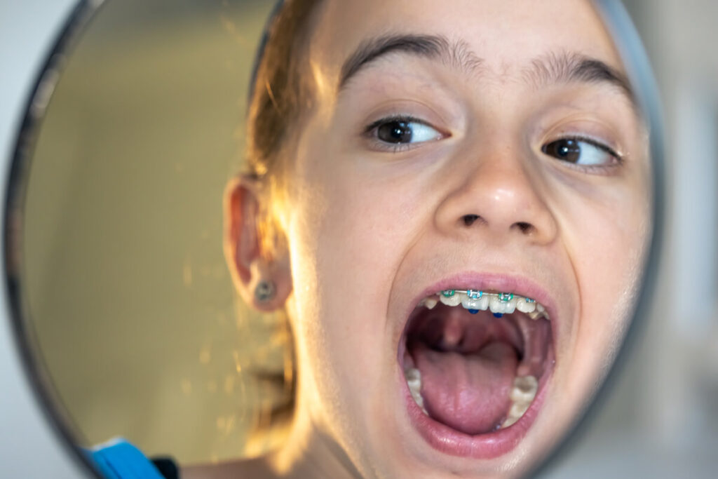 Enfant ou adolescent cherchant un appareil d'orthodontie amovible perdu.