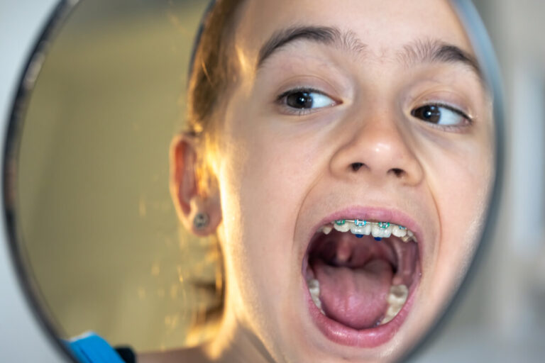 Accueil 1 Enfant ou adolescent cherchant un appareil d'orthodontie amovible perdu.