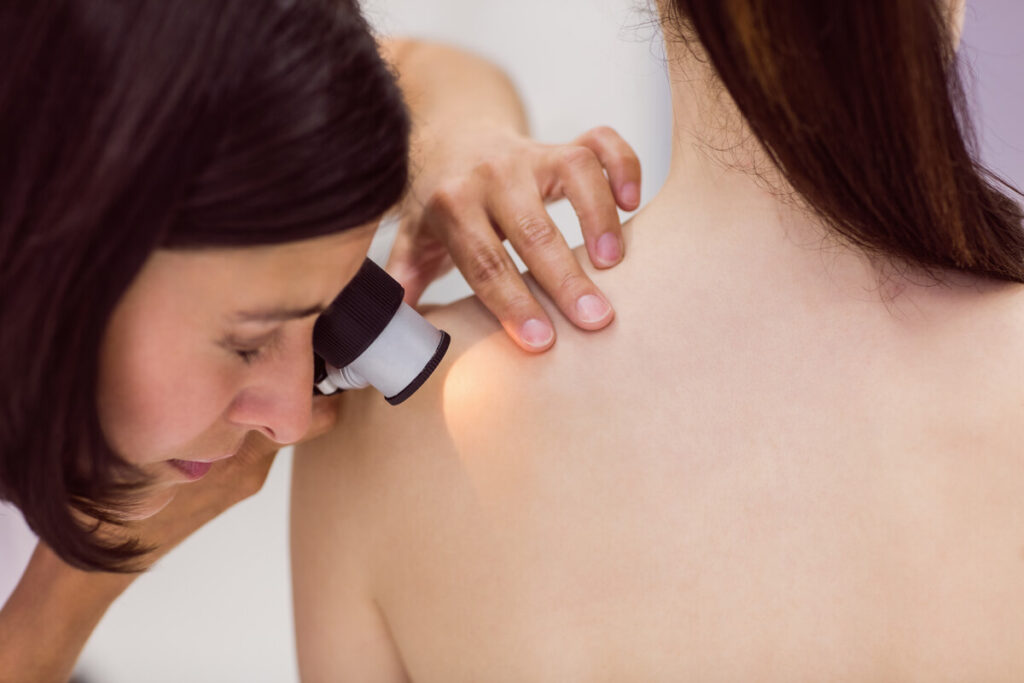 Dermatologue examinant un grain de beauté dans le dos à l'aide d'un dermatoscope lumineux.