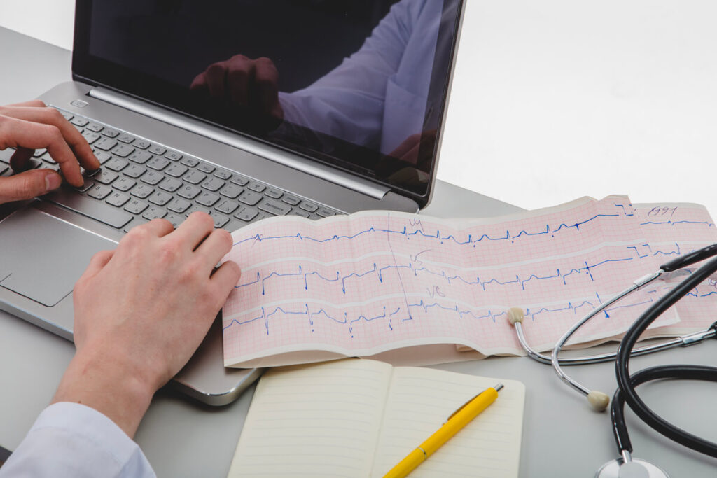 Échec de l'ablation de fibrillation auriculaire : causes et suite 2 Cardiologue rythmologue analysant un électrocardiogramme après une ablation de fibrillation auriculaire.